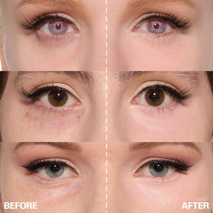 ✨ LAST DAY BUY 1 GET 1 FREE✨Cemenrete Calcium Dark Spot Eye Cream | Dark Circle, Anti-aging, Sagging, Elasticity