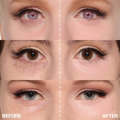 ✨ LAST DAY BUY 1 GET 1 FREE✨Cemenrete Calcium Dark Spot Eye Cream | Dark Circle, Anti-aging, Sagging, Elasticity