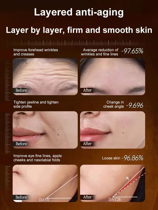 🔥Limited Time Offer🔥One touch to remove-wrinkles Micro-molecular collagen anti-wrinkle lotion