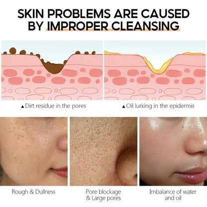 🌟Arbutin whitening cleanser deep cleansingwhitening💎