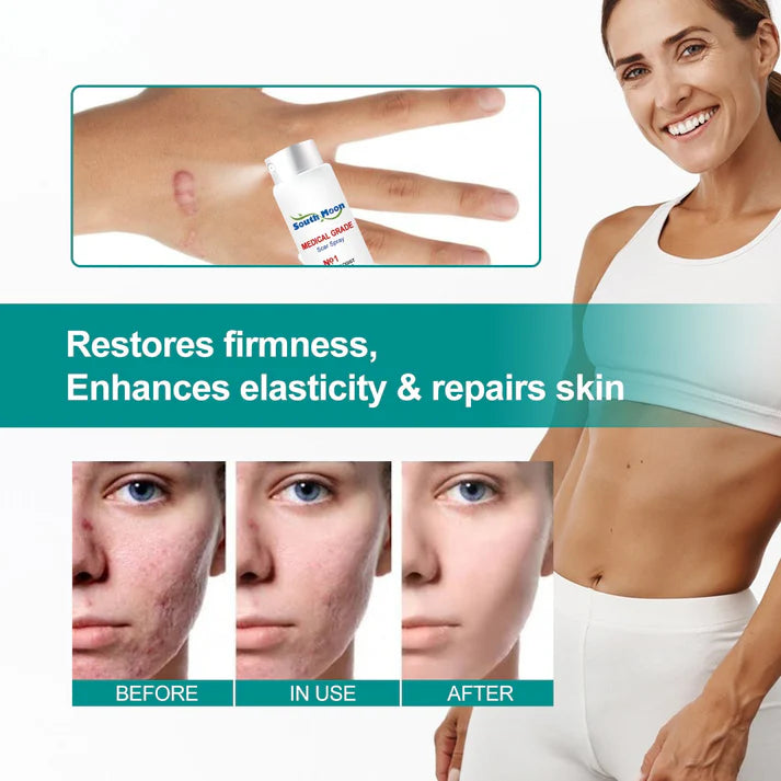 🔥Buy 3 Get 3 Free🔥Advanced ScarRemoval Spray