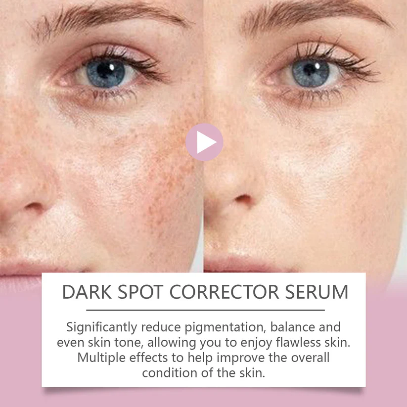 🔥Limited Time Offer🔥Advanced Dark Spot Corrector Serum -Multi-Correction Brightening Formulafor Sun Spots, Age Spots, and Melasma-XXS