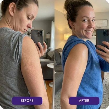 Body oil formulated for cancer survivors. Damaged skin gone in 90 days or full refund.