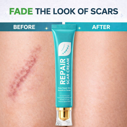 🌿Alisanda Scar Repair Cream|Treats Old and New Scars, Burns and More