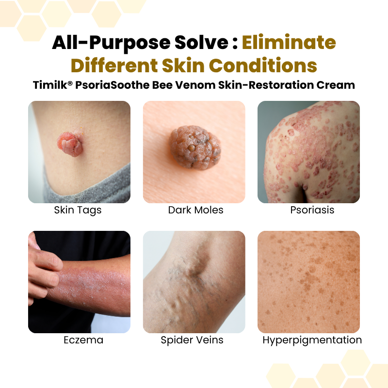 PsoriaSoothe Skin Care Cream