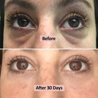 Microneedle Eye Patch – Wake Up to Brighter, Younger-Looking Eyes ✨